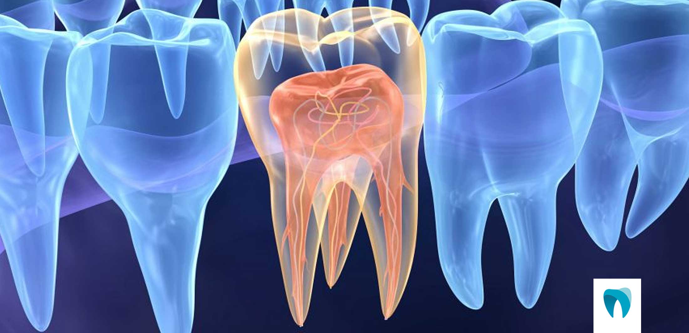 https://www.ortofacil.com.br/wp-content/uploads/2021/06/OFEndodontia.jpg