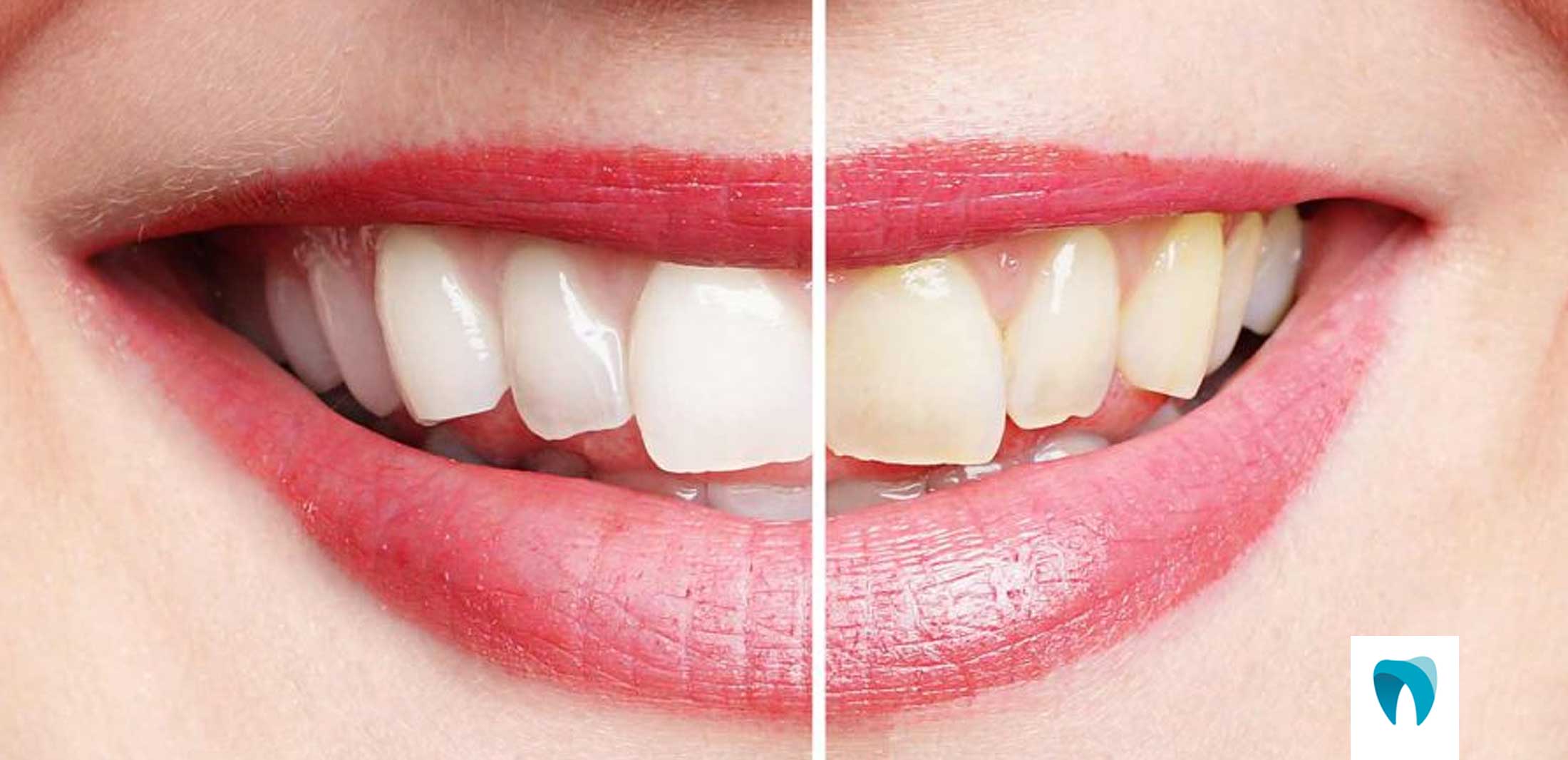 OFEsteticaDental https://www.ortofacil.com.br/wp-content/uploads/2021/06/OFEsteticaDental.jpg